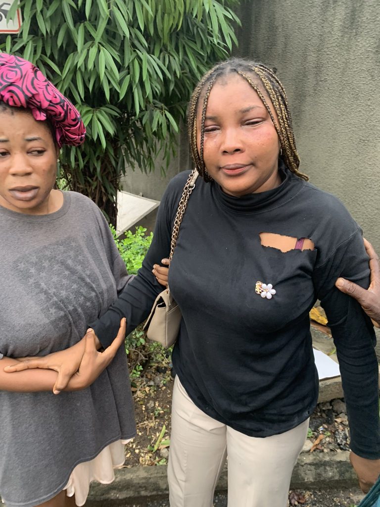 Lady unable to see after falling victim to one-chance in Lagos
