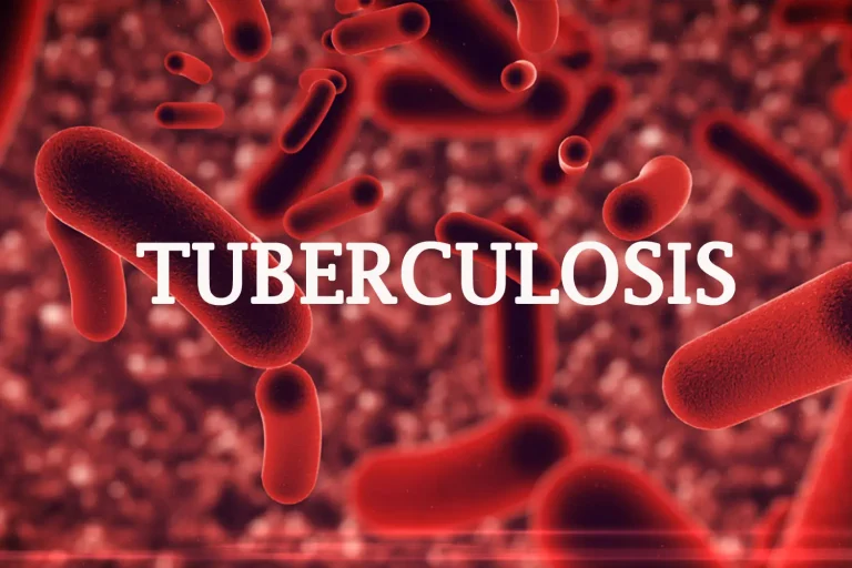 Kaduna records 32,297 Cases of Tuberculosis in 2023